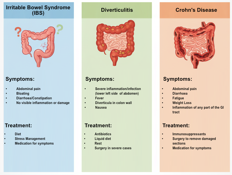 IBS versus Diverticulitis